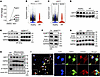 NAMPT regulates SIRT7 expression and SIRT7 deacetylates SOD2 in AT2 cells.