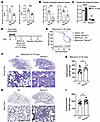AT2-specific Nampt deletion impairs AT2 progenitor renewal and increases lu