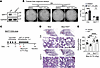 The effects of NAMPT activation on AT2 regeneration and lung fibrosis are a