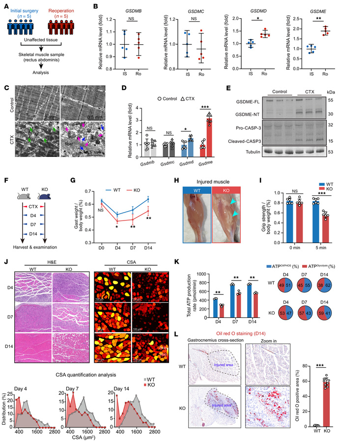GSDME is activated in injured skeletal muscle, while its KO hinders tiss...