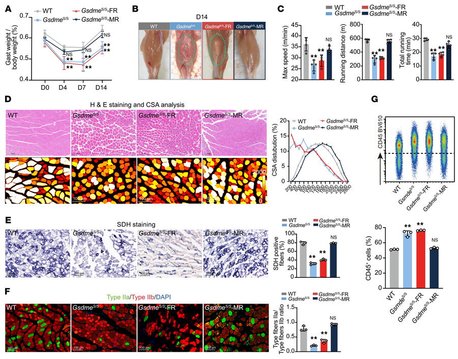 GSDME in recruited macrophages, but not in FAPs, is essential for skelet...