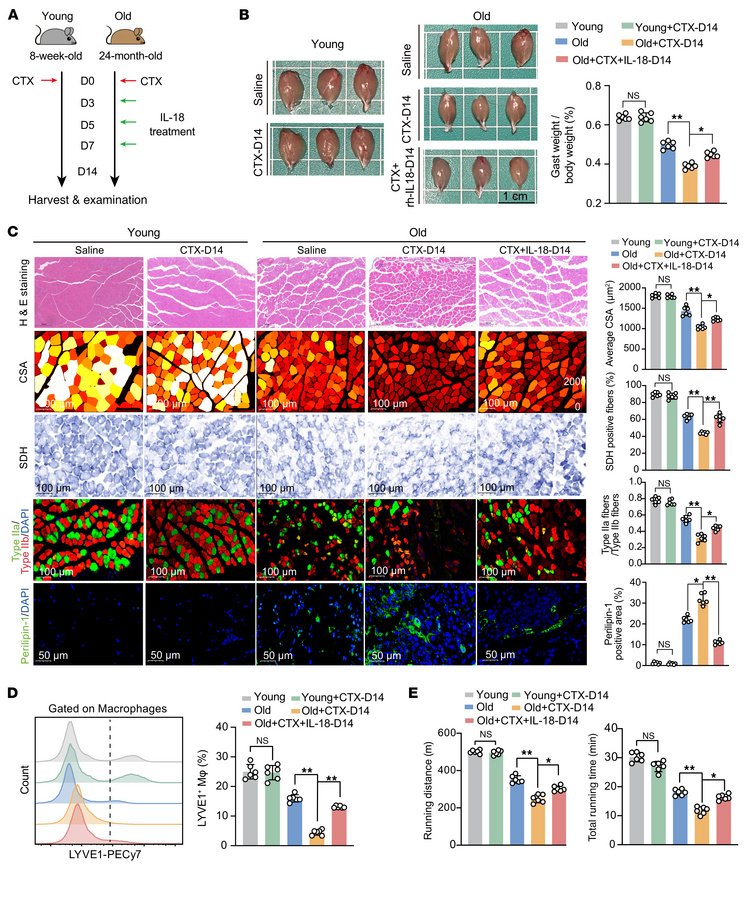 Administration of IL-18 rectifies aging-associated defective skeletal mu...