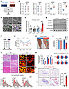 GSDME is activated in injured skeletal muscle, while its KO hinders tissue