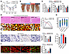 GSDME in recruited macrophages, but not in FAPs, is essential for skeletal