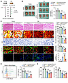 Administration of IL-18 rectifies aging-associated defective skeletal muscl