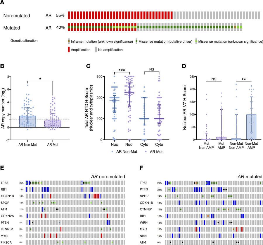 
AR amplification and AR-V7 expression in AR-mutated mCRPC clinical biop...