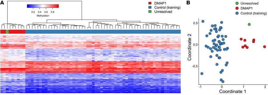 Identified episignature enabled identification of DMAP1 variants in a pr...
