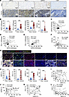Positive correlation of SIRT2 with PD-L1 expression in human bladder cancer