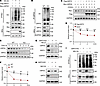 SIRT2 promotes USP22 ubiquitination.