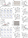 SIRT2 blockade combined with anti–PD-1 therapy effectively inhibited tumor