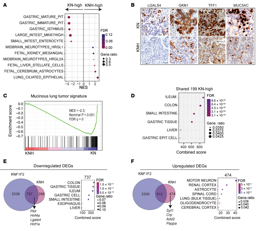 HNF4α maintains gastric differentiation and suppresses transcriptional p...