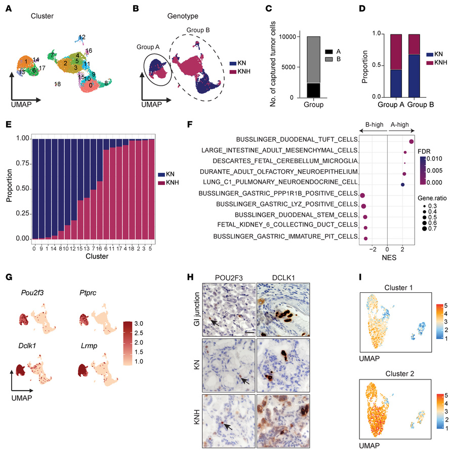 HNF4α constraints cellular heterogeneity in IMA at single-cell resolutio...