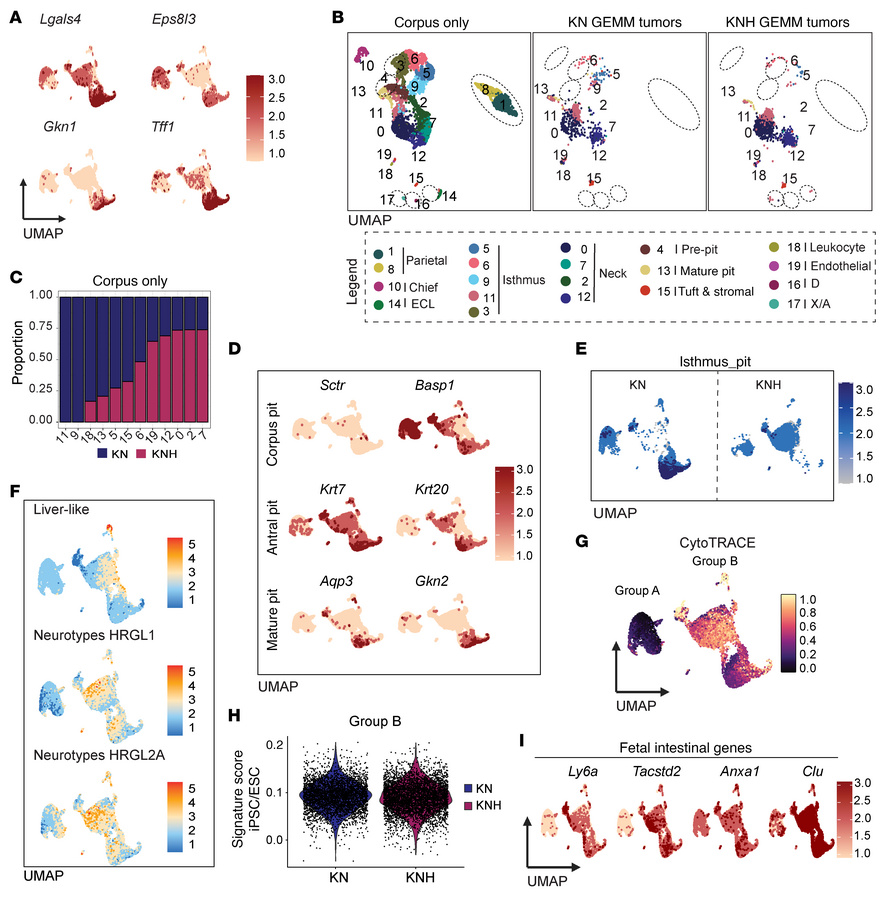HNF4α sustains a stomach-like gastric lineage program in IMA at single-c...