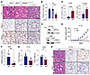 HNF4α is essential for in vivo growth of established IMA.