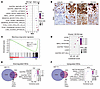 HNF4α maintains gastric differentiation and suppresses transcriptional plas