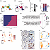 HNF4α constraints cellular heterogeneity in IMA at single-cell resolution.