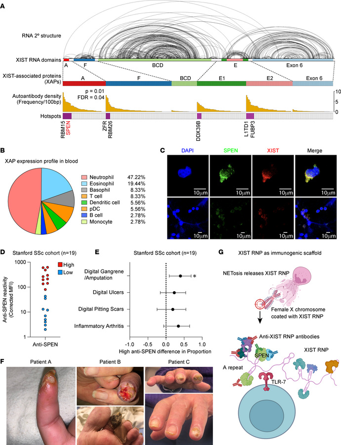 Immunogenic XAPs are released by NETosis and associated with high-risk v...