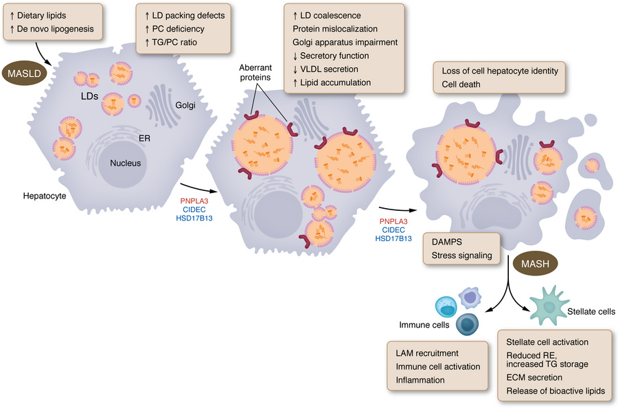 Model for involvement of lipid droplets in MASLD.
Dietary lipids and inc...