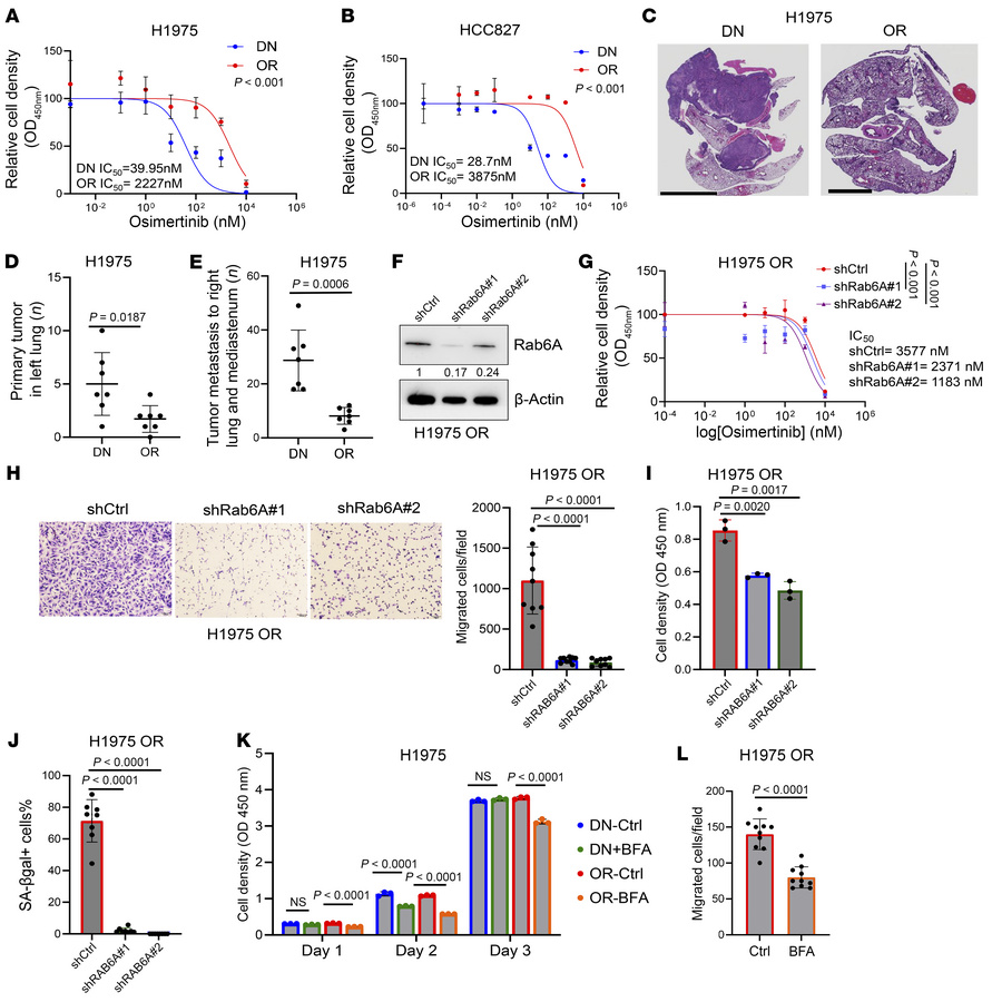 Secretory processes drive biological differences between drug-naive (DN)...