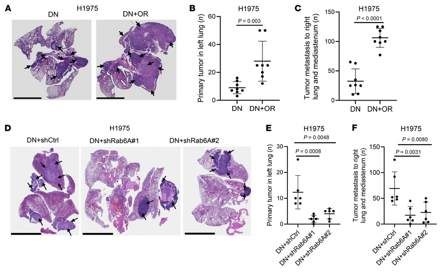OR cells exert paracrine effects on DN cells in tumor models.
(A–C) Hist...