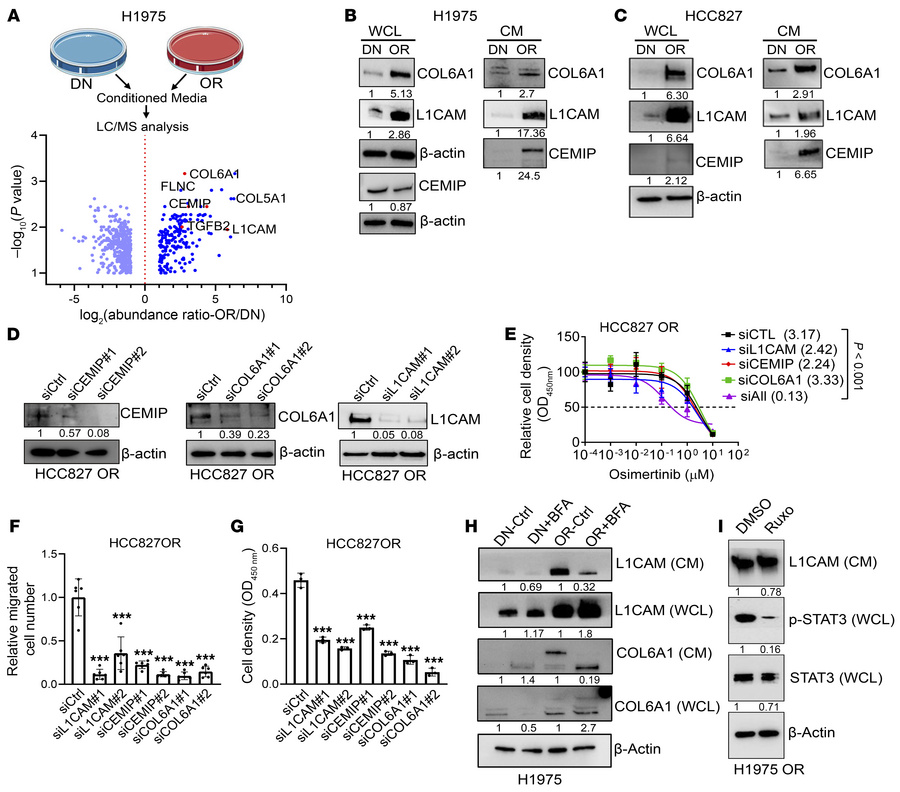 Identification of secretory mediators in H1975 OR cells.
(A) Volcano plo...