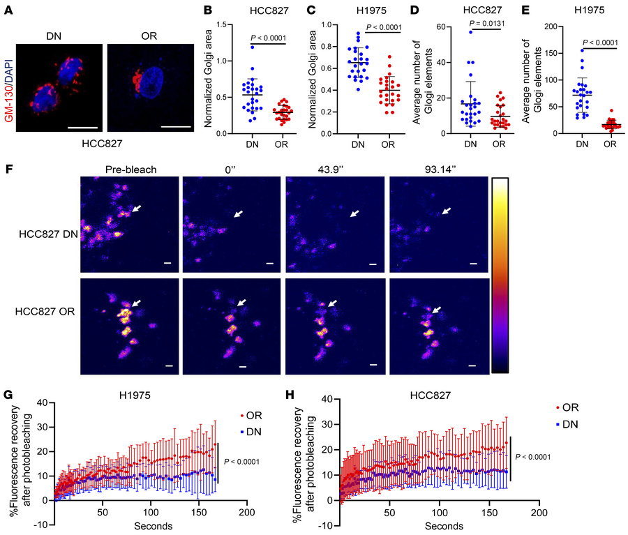 Distinct Golgi dynamics in OR cells and DN cells.
(A) Confocal micrograp...