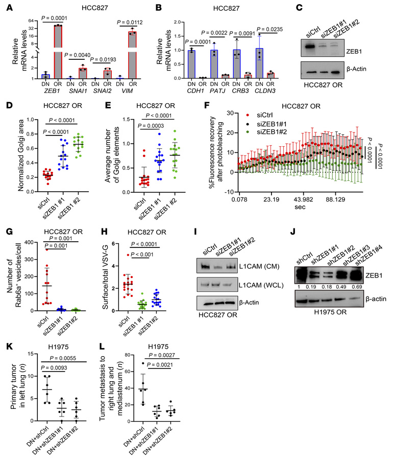 EMT drives Golgi and secretory dynamics in OR cells.
(A and B) Quantitat...