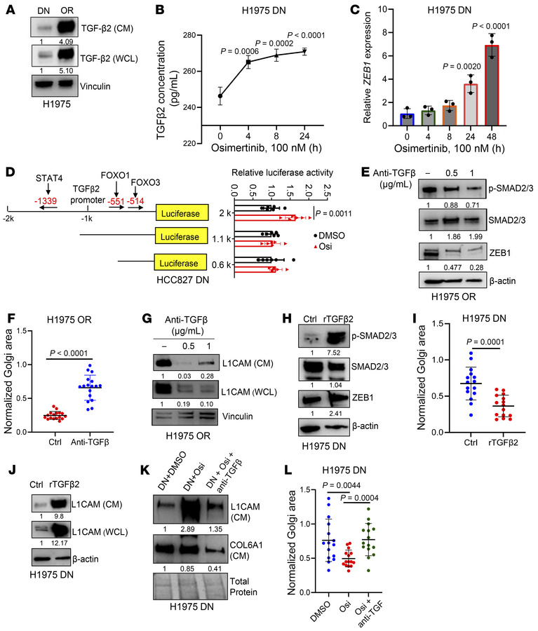 Osimertinib activates TGF-β2 secretion to initiate the EMT-dependent sec...