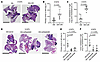 OR cells exert paracrine effects on DN cells in tumor models.