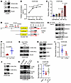 Osimertinib activates TGF-β2 secretion to initiate the EMT-dependent secret