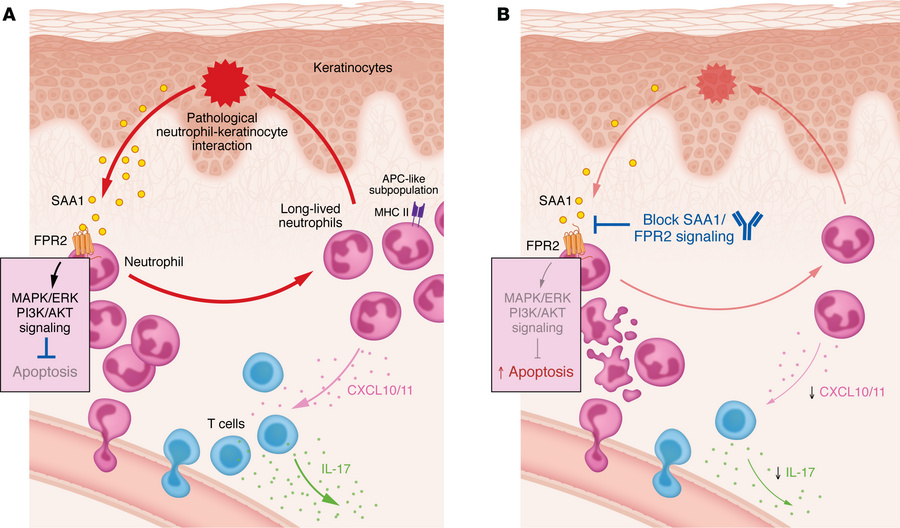 SAA1/FPR2 signaling prolongs neutrophil survival and provides a therapeu...
