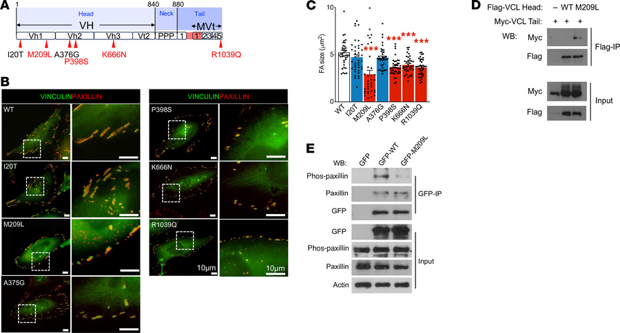HSCR-associated mutations in VCL interrupt focal adhesion assembly.
(A) ...