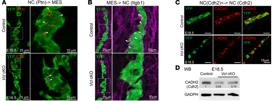 Downregulation of PTN, ITGB1 and CADH2 in Vcl-deficient ENS at E18.5.
IH...