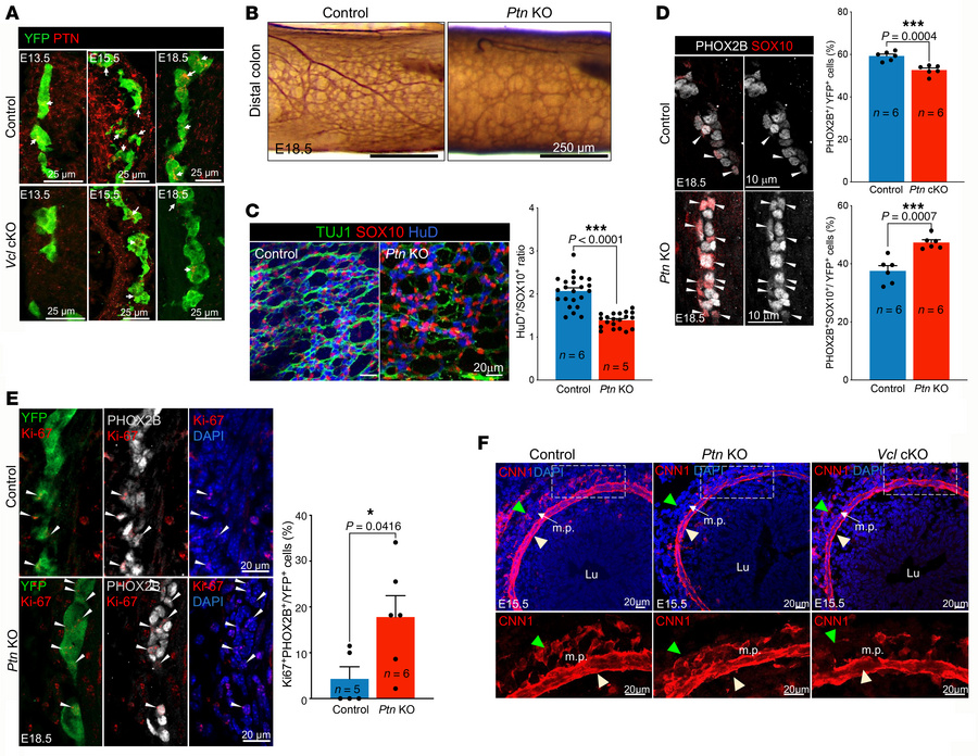 Dynamic expression of PTN in ENS and mesenchyme is essential for the for...