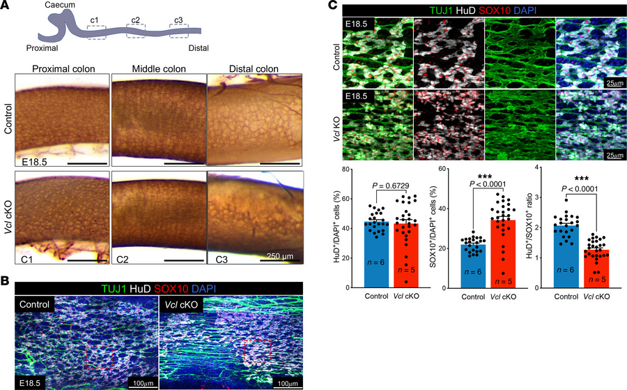 Malformation of enteric ganglia in Vcl cKO at E18.5.
(A) Three regions (...
