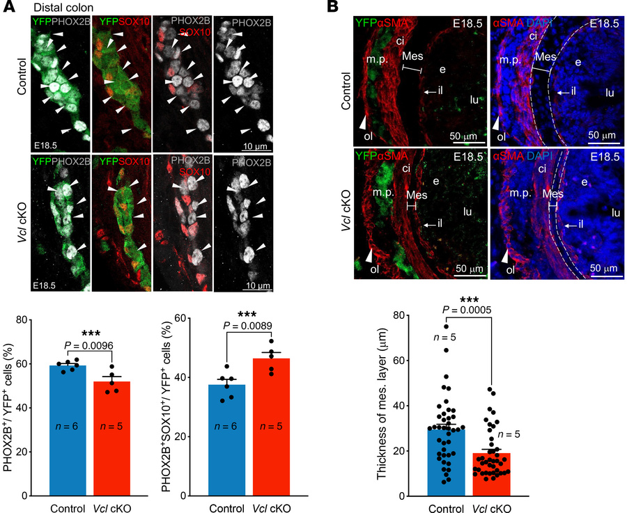 Immature ENS in Vcl cKO at E18.5.
Immunofluorescence of (A) PHOX2B &amp;...