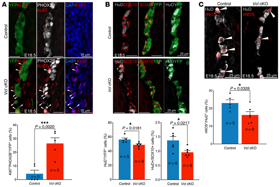 Increased progenitor cells and delayed differentiation in Vcl mutants.
(...
