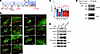 HSCR-associated mutations in VCL interrupt focal adhesion assembly.