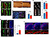 Dynamic expression of PTN in ENS and mesenchyme is essential for the format