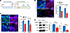 VCL is implicated in multiple stages of neuronal lineage differentiation of