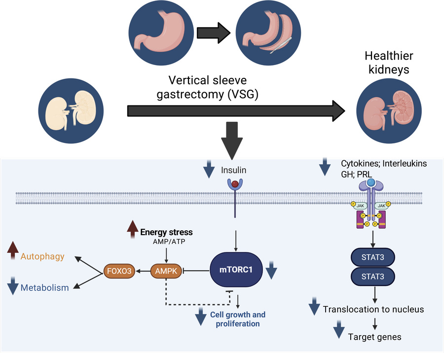 graphical abstract
