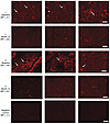Reduction in rpS6 staining in baseline and 12-month kidney biopsies from yo