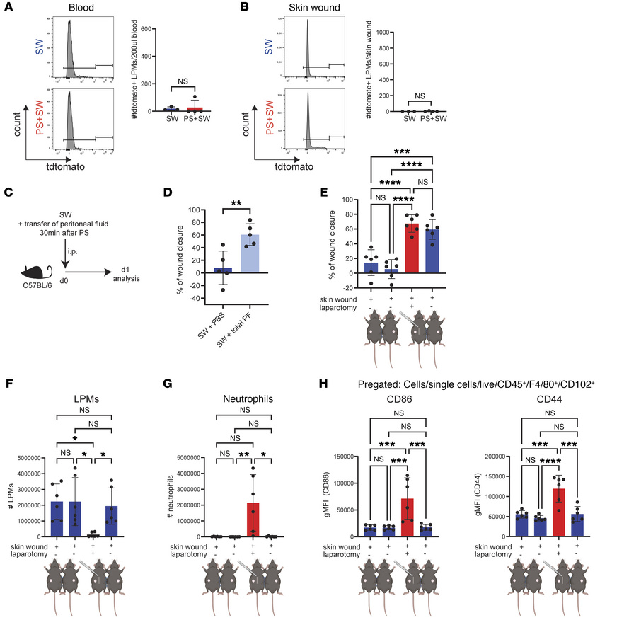 LPM-derived soluble factor promote skin wound healing following peritone...