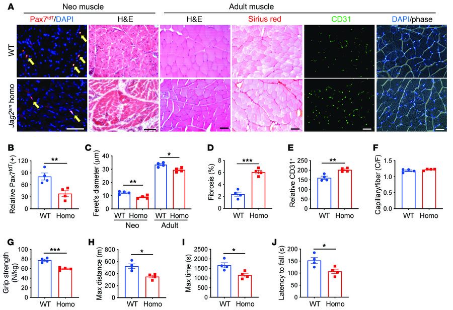 Muscle phenotypes in Jag2sm mice.
(A–F) Muscle from 4-day-old and 3-mont...