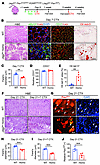 Jag2sm hypomorphic mice have muscle regenerative defects.