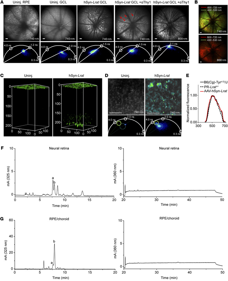 Retinosome-like structures in the mouse GCL after intravitreal injection...