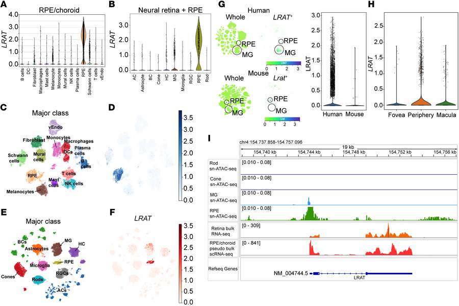 Expression of LRAT in the cell types of adult human RPE/choroid and reti...