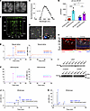 Retinosome-like structures within MGs after intravitreal and subretinal inj
