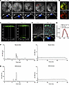 Retinosome-like structures in the mouse GCL after intravitreal injection wi