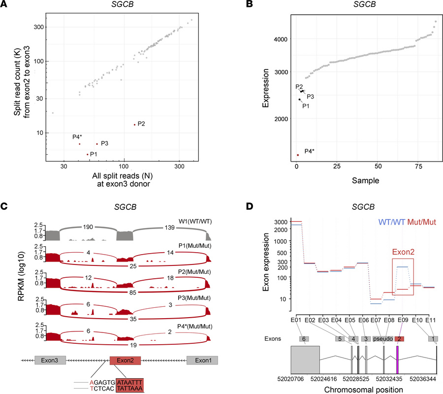 Aberrant splicing and altered expression of SGCB in cardiac tissue from ...